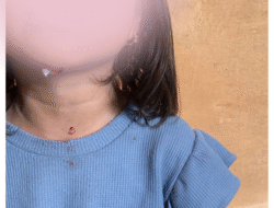 Tragis di Rokan Hulu, Anak Jadi Korban Kekerasan Ayah Tiri: Kini dalam Perlindungan Germas PPA